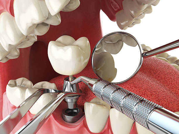 Best Emergency Root Canal Therapy in Wilson, WY
